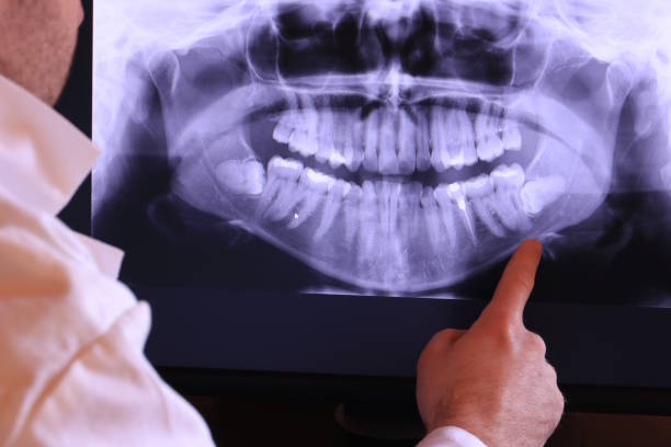 Best Emergency Care for Gum Disease in Fletcher, NC