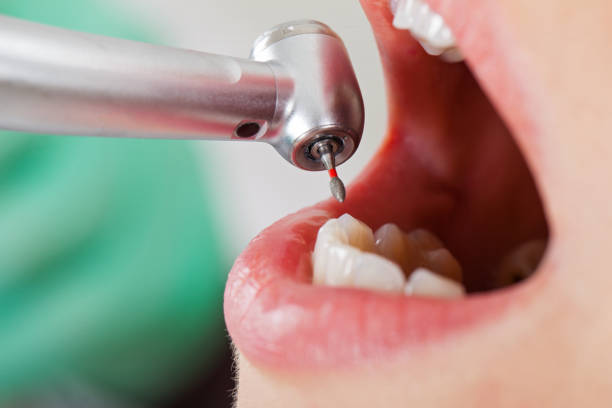 Best Emergency Denture Repair in Fletcher, NC